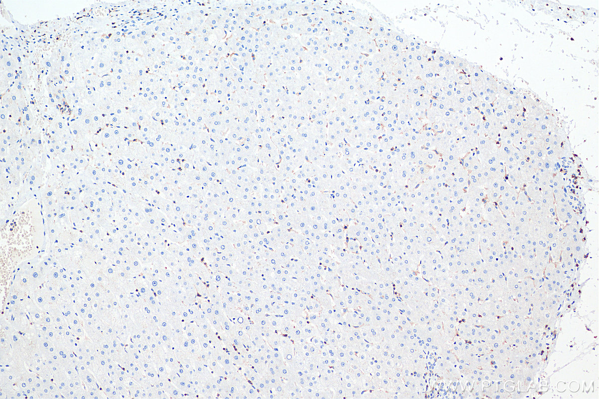 Immunohistochemical analysis of paraffin-embedded human liver tissue slide using KHC0031 (CD45 IHC Kit).