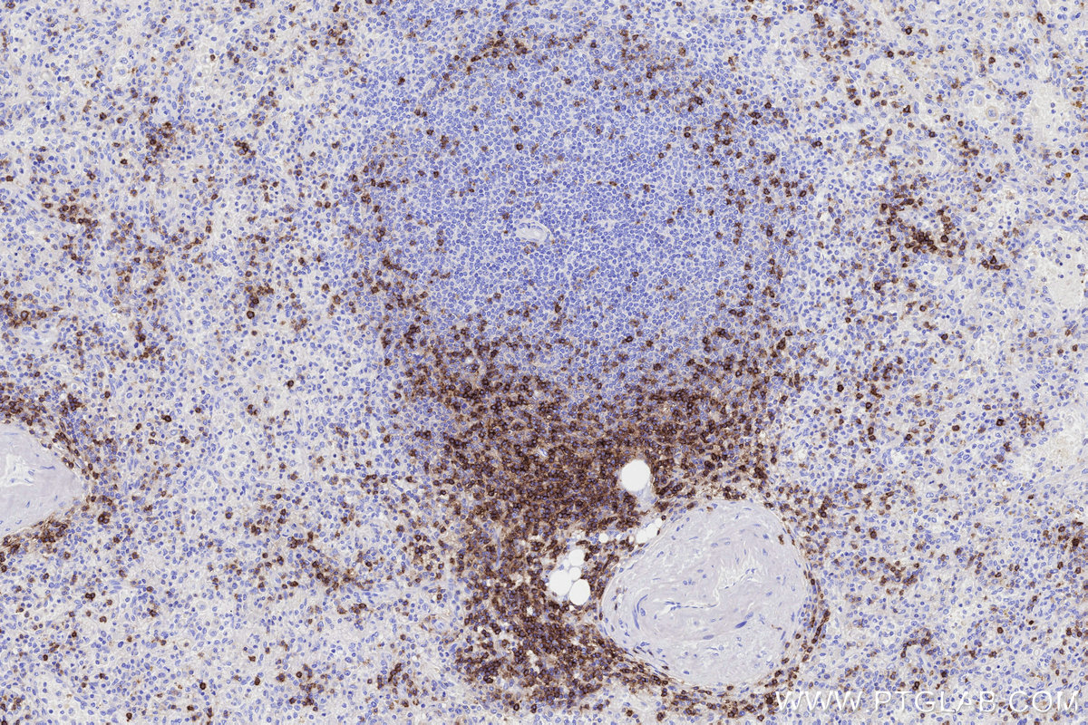 Immunohistochemical analysis of paraffin-embedded human spleen tissue slide using KHC3311 (CD5 IHC Kit).