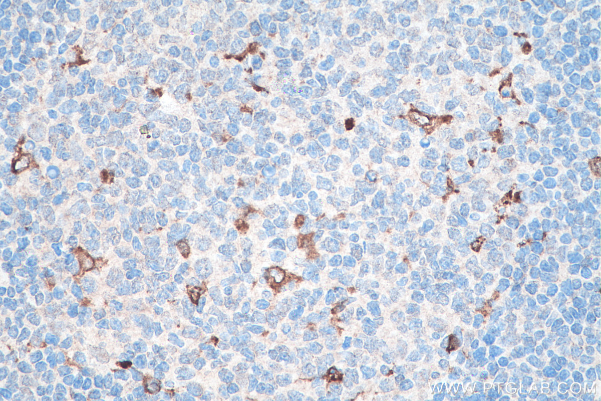 Immunohistochemical analysis of paraffin-embedded human tonsillitis tissue slide using KHC0006 (CD68 IHC Kit).