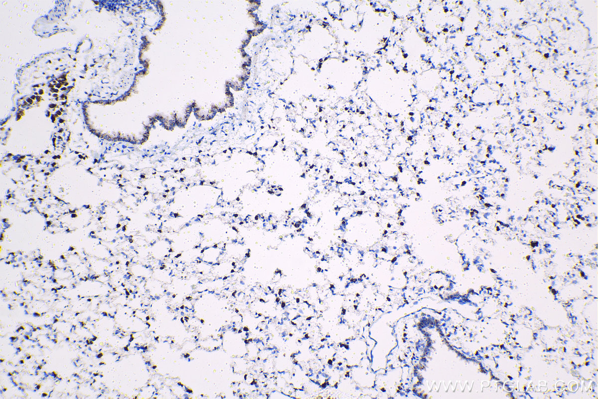 Immunohistochemical analysis of paraffin-embedded rat lung tissue slide using KHC1414 (CD68 IHC Kit).