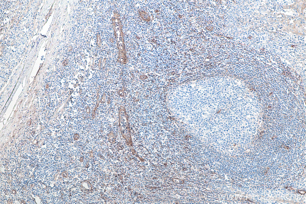 Immunohistochemical analysis of paraffin-embedded human tonsillitis tissue slide using KHC0081 (CD90 IHC Kit).