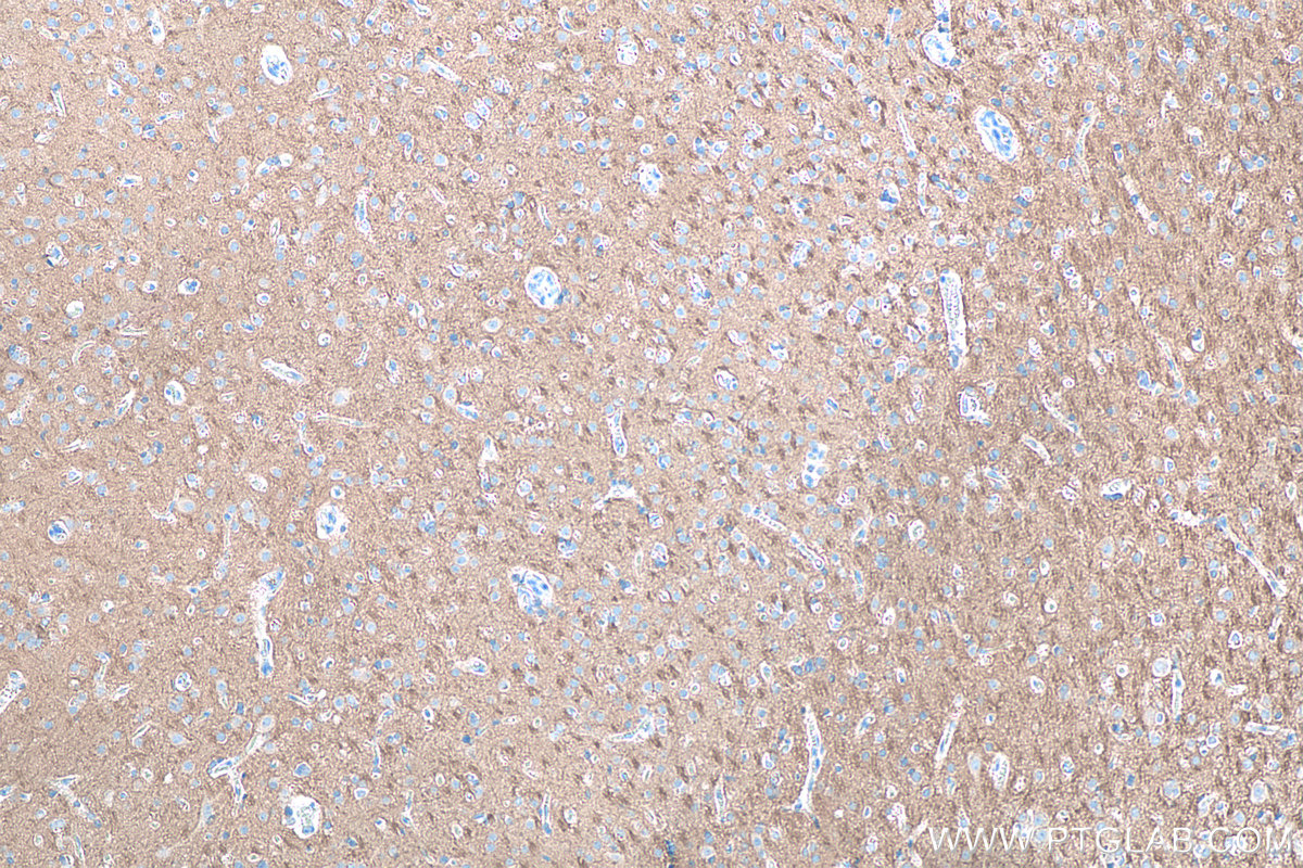 Immunohistochemical analysis of paraffin-embedded human Occipital Cortex tissue slide using KHC0081 (CD90 IHC Kit).