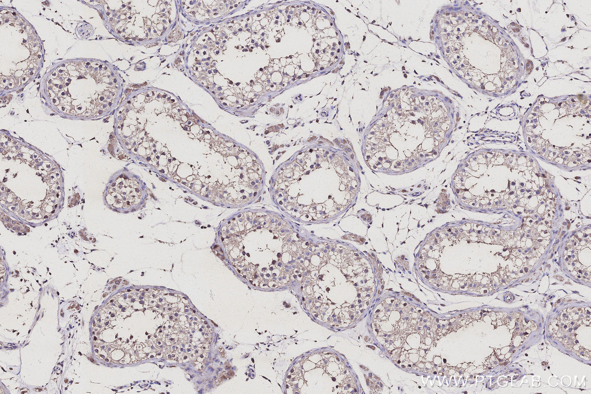 Immunohistochemical analysis of paraffin-embedded human testis tissue slide using KHC3124 (CDC123 IHC Kit).