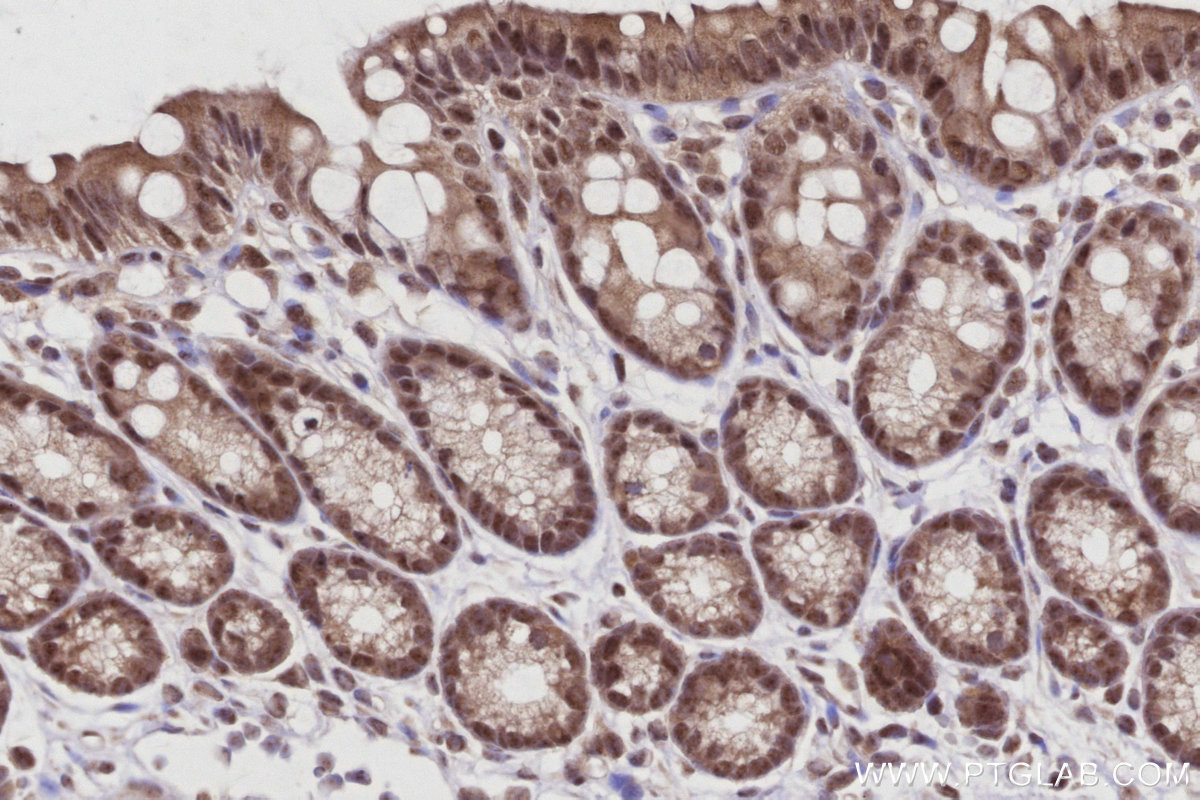 Immunohistochemical analysis of paraffin-embedded mouse colon tissue slide using KHC3019 (CDC23 IHC Kit).