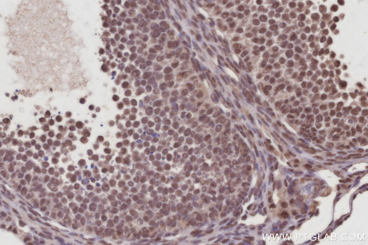 Immunohistochemical analysis of paraffin-embedded mouse ovary tissue slide using KHC3019 (CDC23 IHC Kit).
