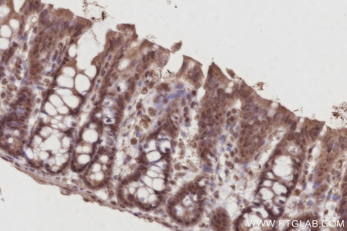 Immunohistochemical analysis of paraffin-embedded rat colon tissue slide using KHC3019 (CDC23 IHC Kit).