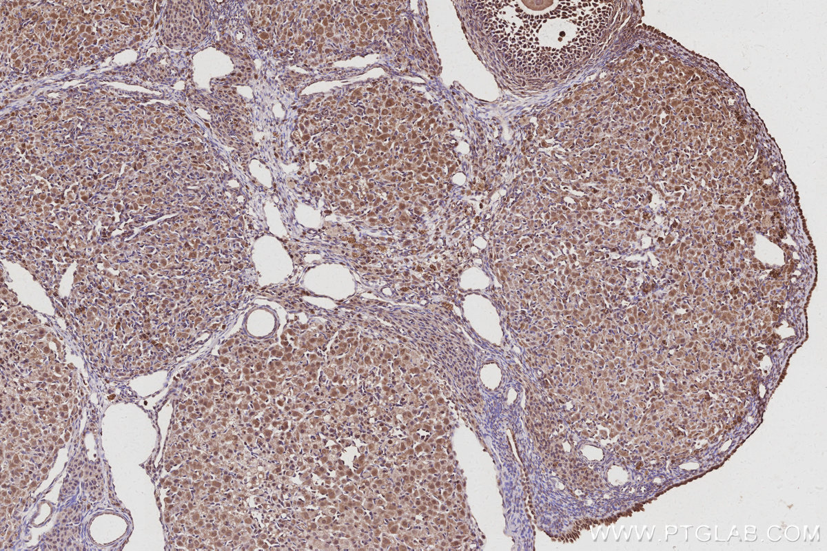 Immunohistochemical analysis of paraffin-embedded rat ovary tissue slide using KHC3019 (CDC23 IHC Kit).
