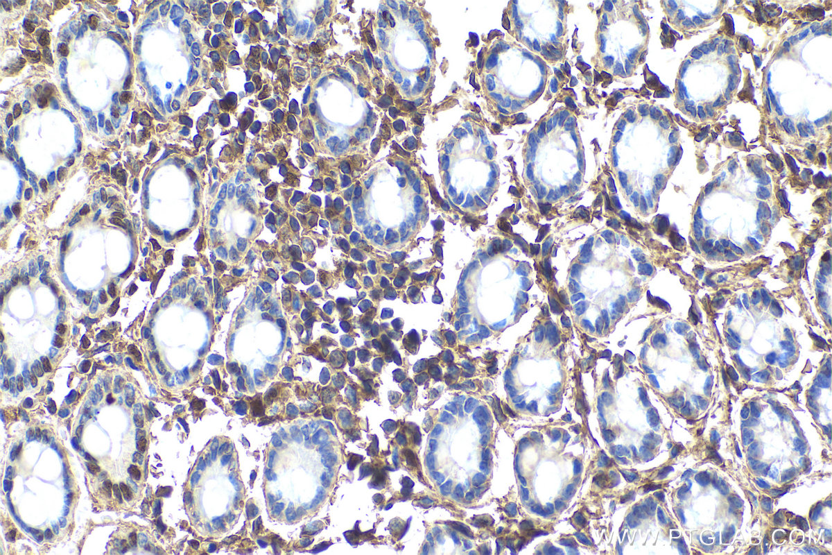 Immunohistochemical analysis of paraffin-embedded rat colon tissue slide using KHC0805 (CDC25B IHC Kit).