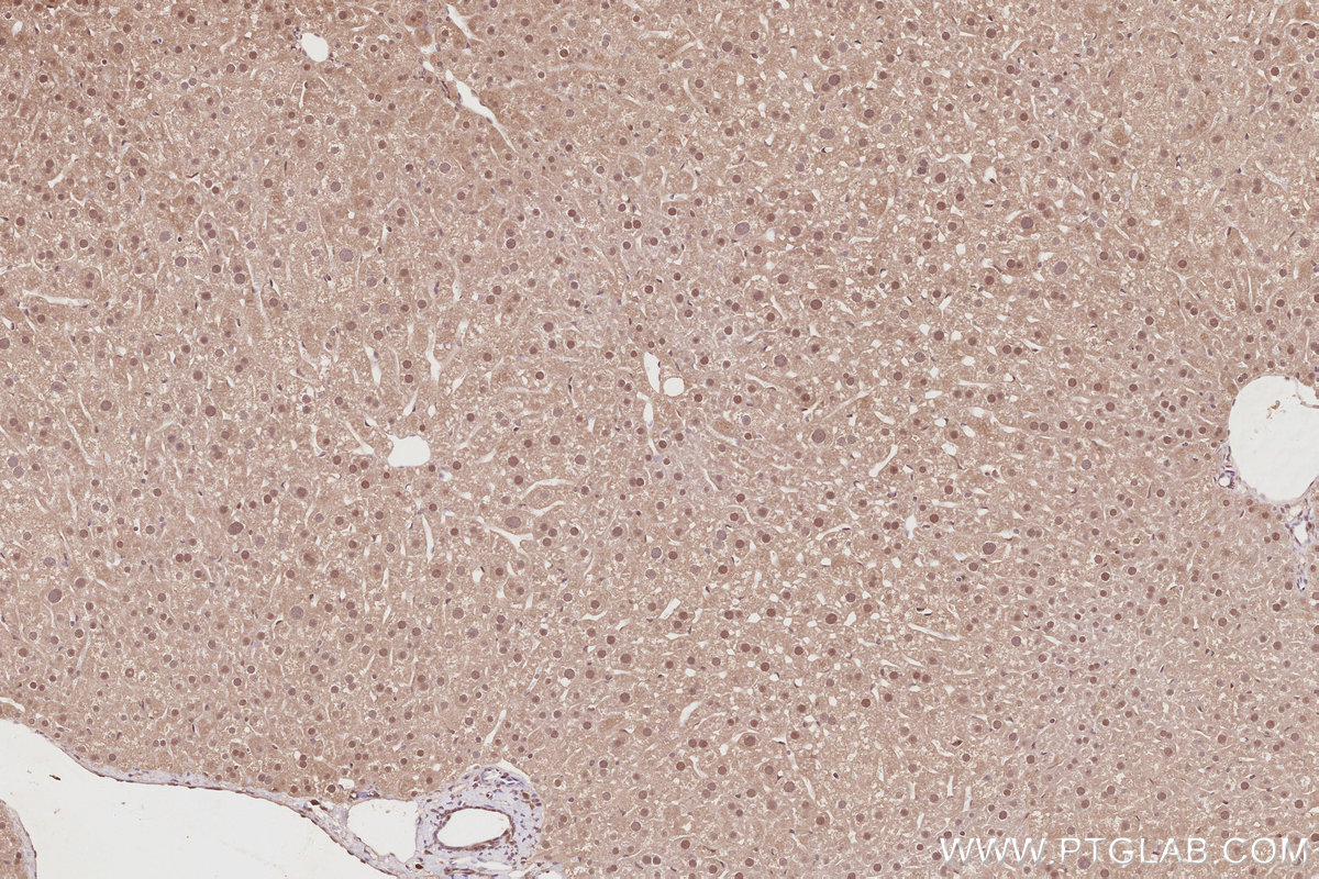 Immunohistochemical analysis of paraffin-embedded mouse liver tissue slide using KHC2879 (CDC2L6 IHC Kit).