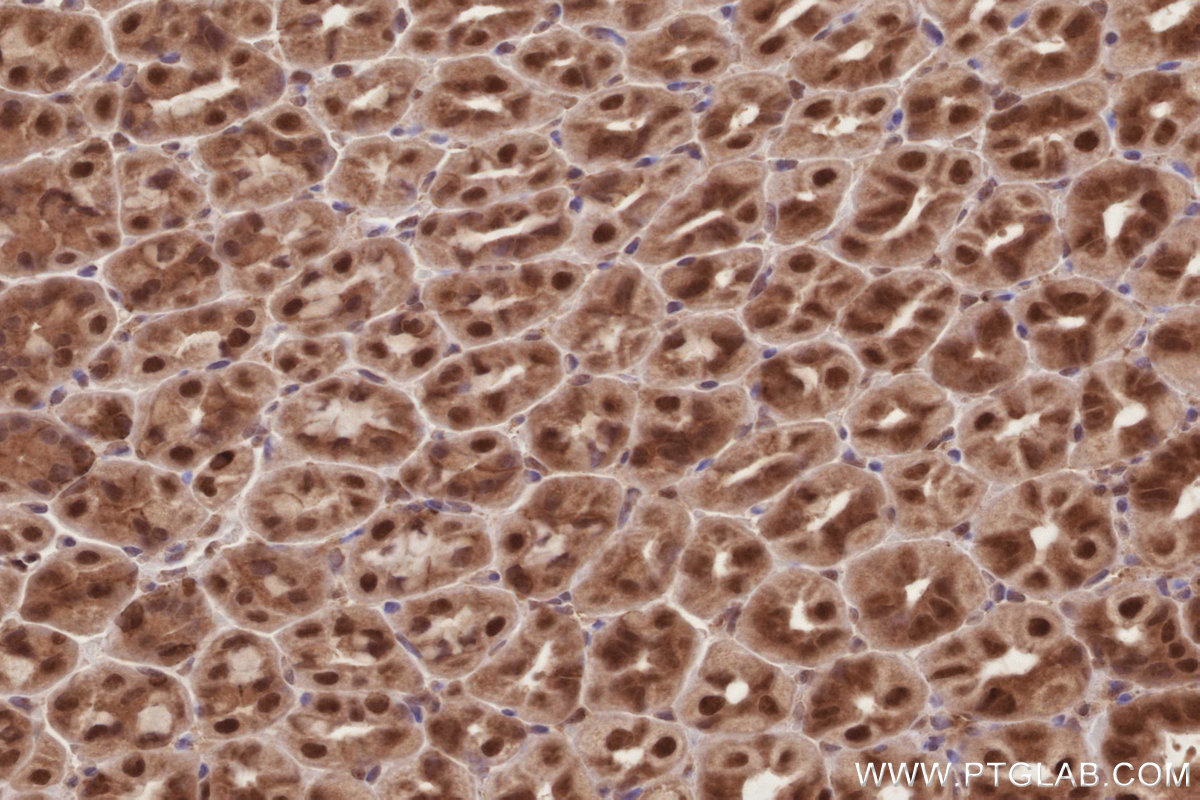 Immunohistochemical analysis of paraffin-embedded mouse stomach tissue slide using KHC2879 (CDC2L6 IHC Kit).