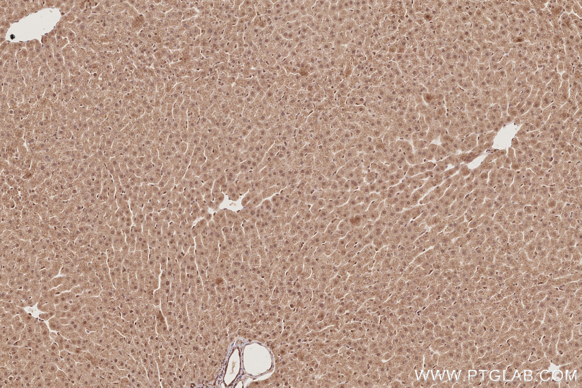 Immunohistochemical analysis of paraffin-embedded rat liver tissue slide using KHC2879 (CDC2L6 IHC Kit).