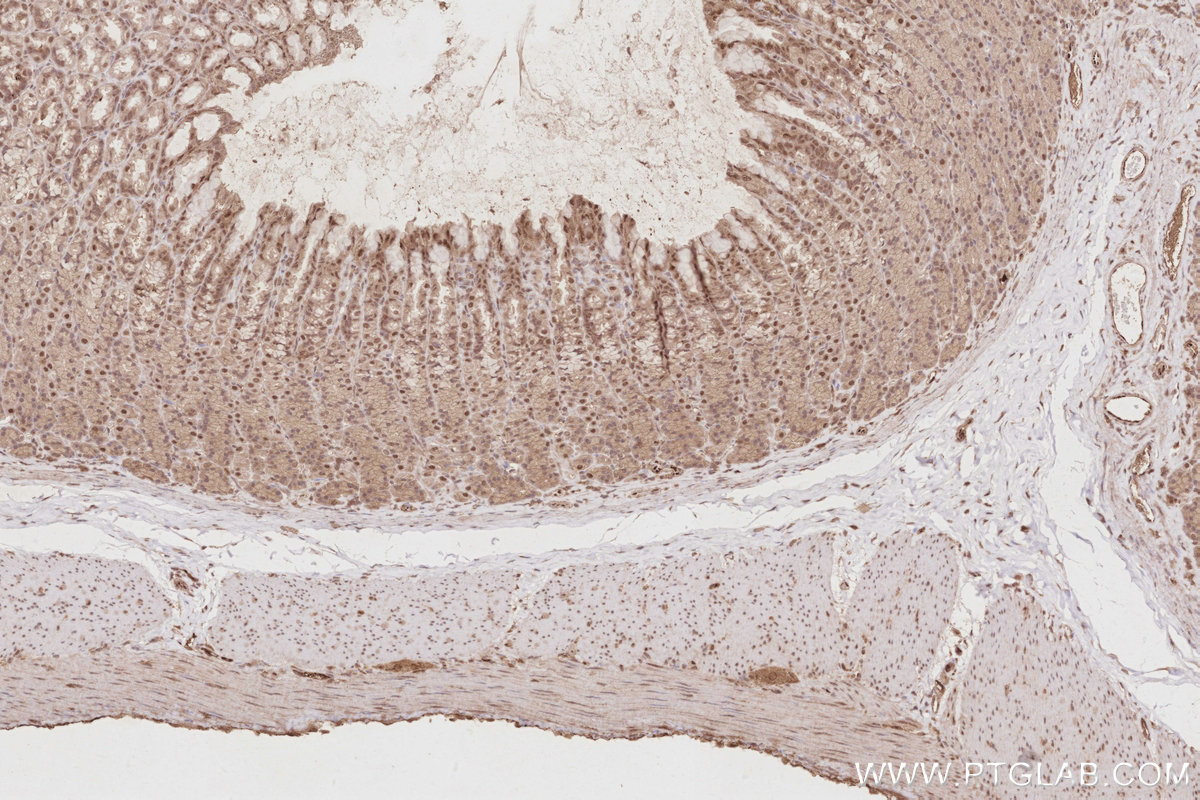 Immunohistochemical analysis of paraffin-embedded rat stomach tissue slide using KHC2879 (CDC2L6 IHC Kit).