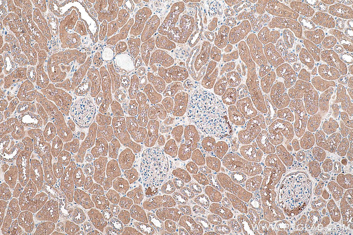 Immunohistochemical analysis of paraffin-embedded human kidney tissue slide using KHC0408 (CDC37L1 IHC Kit).