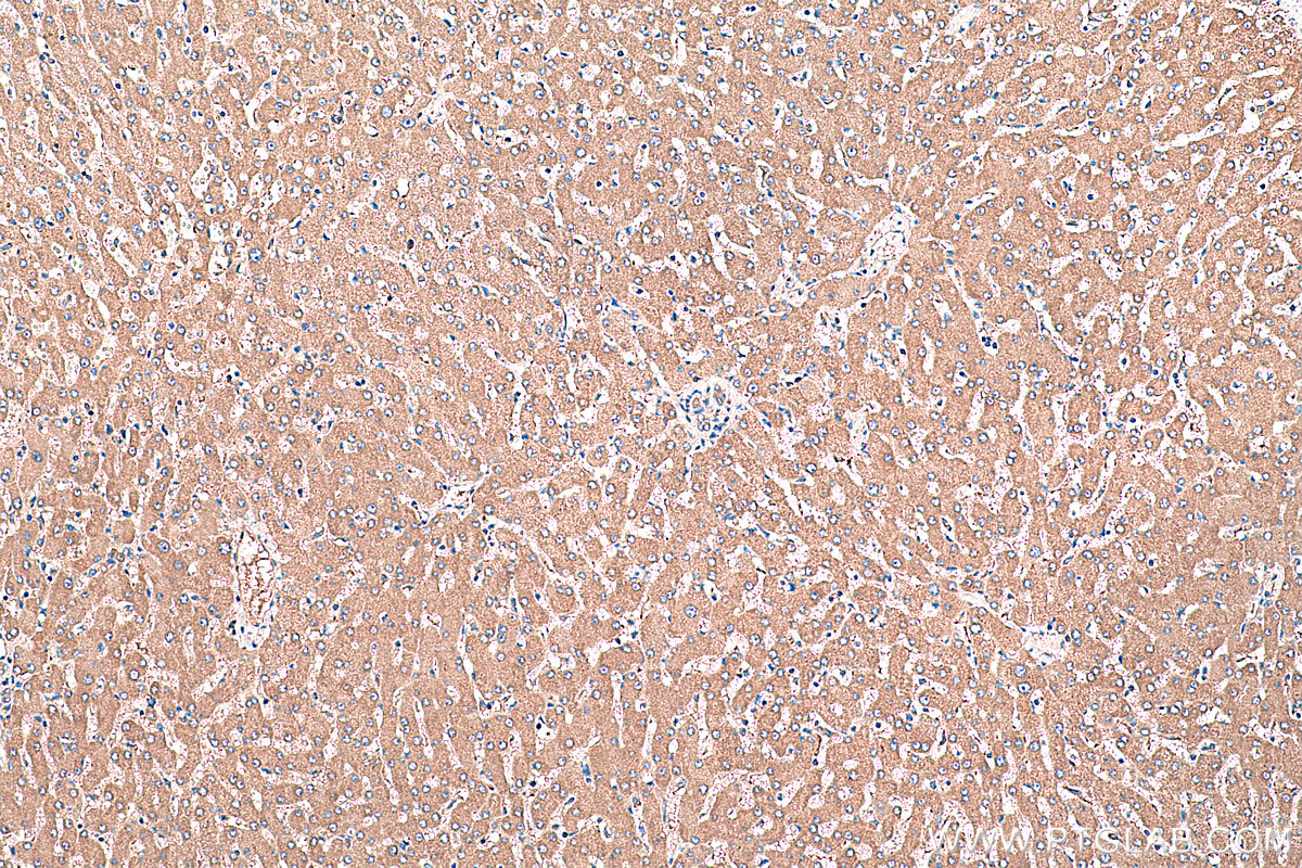 Immunohistochemical analysis of paraffin-embedded human liver tissue slide using KHC0408 (CDC37L1 IHC Kit).