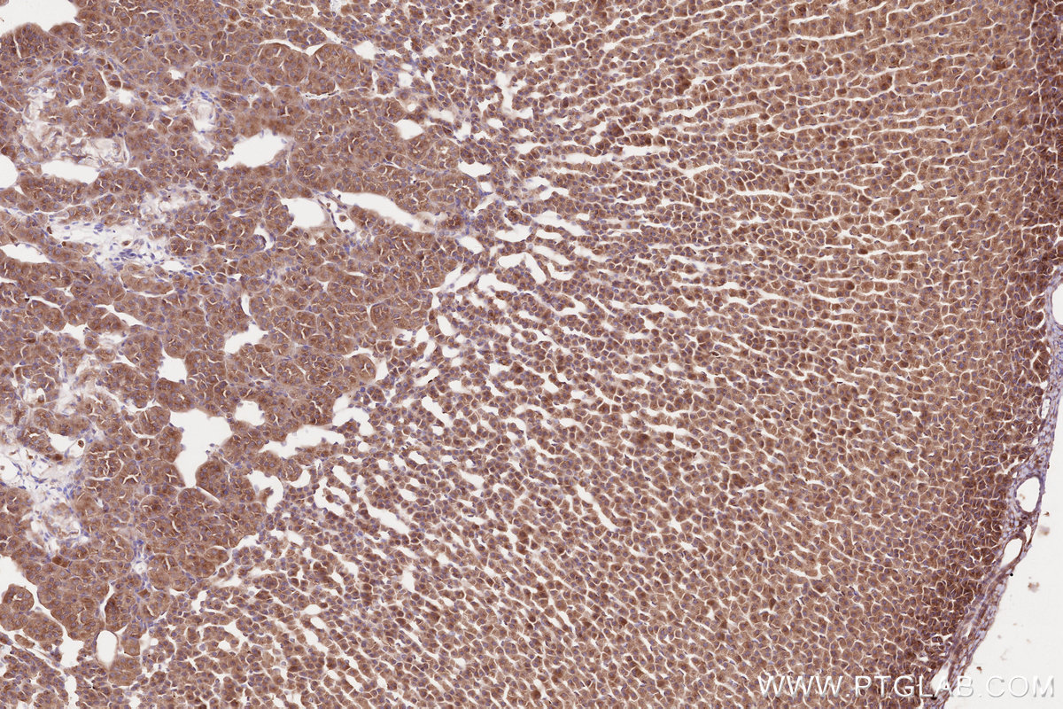 Immunohistochemical analysis of paraffin-embedded rat adrenal gland tissue slide using KHC2562 (CDC42BPA IHC Kit).