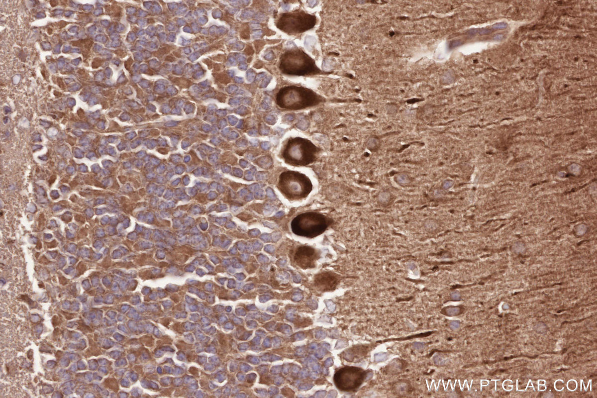 Immunohistochemical analysis of paraffin-embedded mouse cerebellum tissue slide using KHC2562 (CDC42BPA IHC Kit).