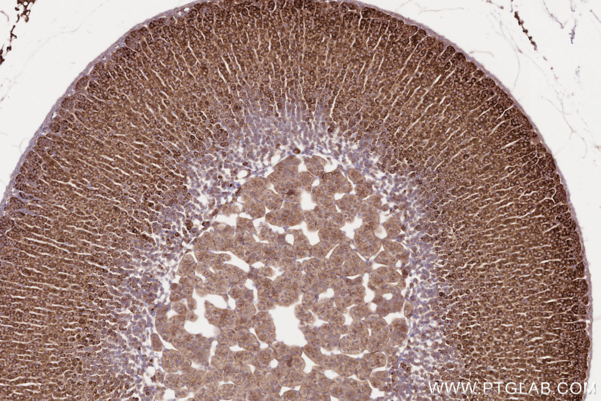 Immunohistochemical analysis of paraffin-embedded mouse adrenal gland tissue slide using KHC2562 (CDC42BPA IHC Kit).