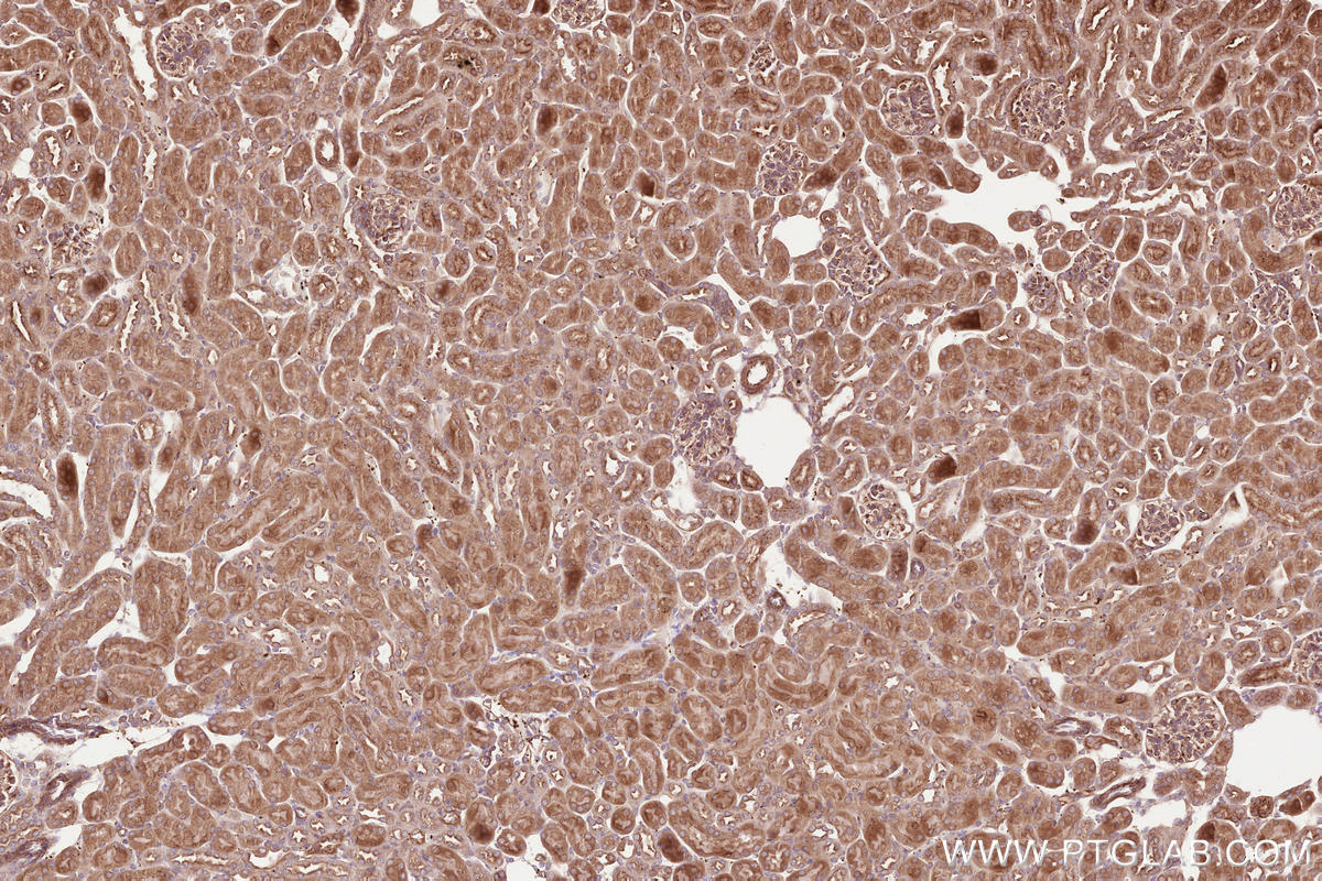 Immunohistochemical analysis of paraffin-embedded mouse kidney tissue slide using KHC2562 (CDC42BPA IHC Kit).