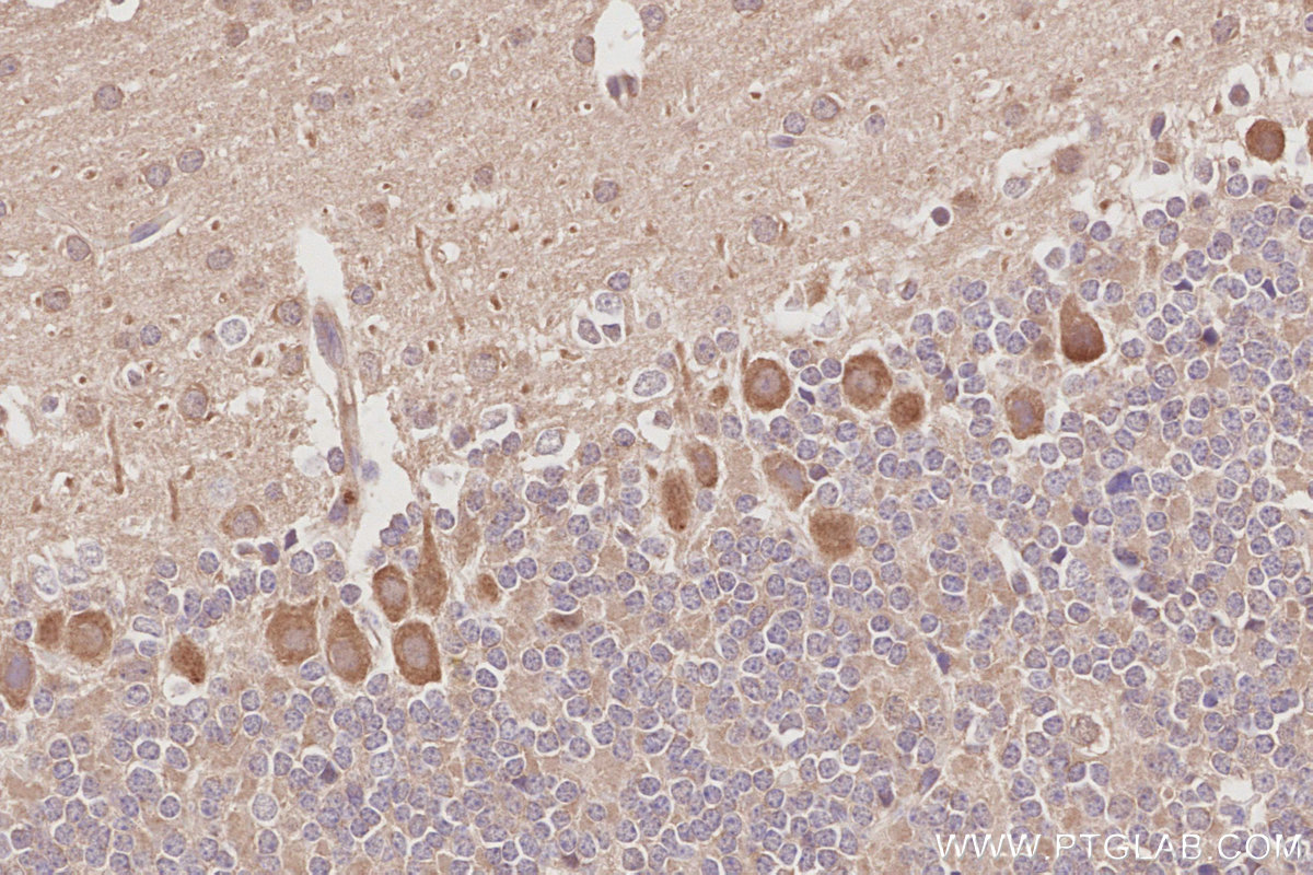 Immunohistochemical analysis of paraffin-embedded mouse cerebellum tissue slide using KHC3080 (CDC42BPB IHC Kit).