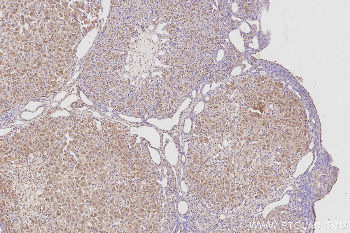 Immunohistochemical analysis of paraffin-embedded rat ovary tissue slide using KHC3080 (CDC42BPB IHC Kit).