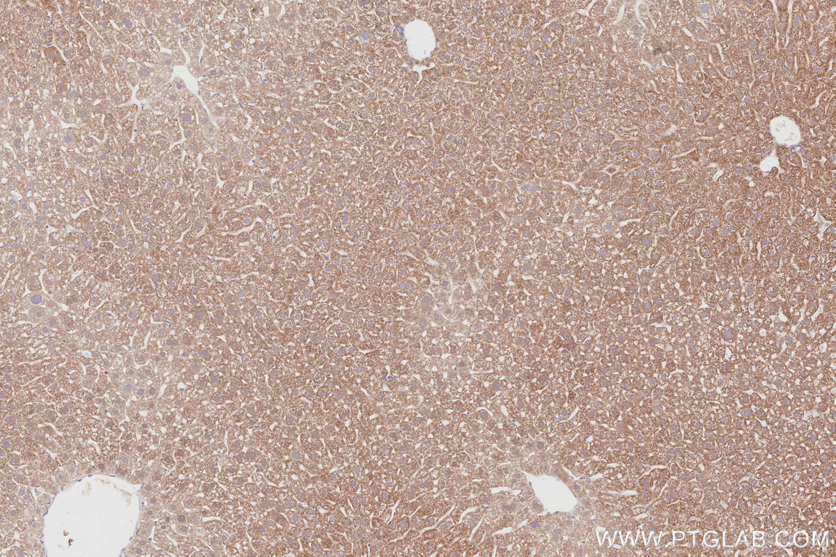 Immunohistochemical analysis of paraffin-embedded mouse liver tissue slide using KHC2911 (CDC42EP4 IHC Kit).