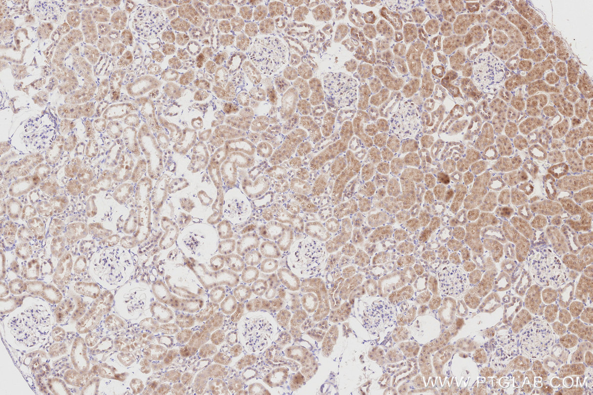 Immunohistochemical analysis of paraffin-embedded rat kidney tissue slide using KHC2911 (CDC42EP4 IHC Kit).