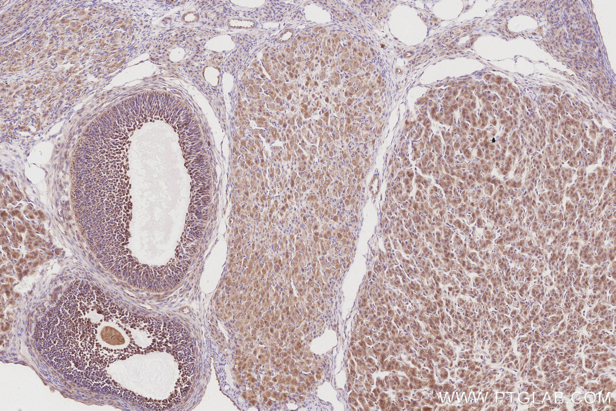 Immunohistochemical analysis of paraffin-embedded rat ovary tissue slide using KHC2911 (CDC42EP4 IHC Kit).