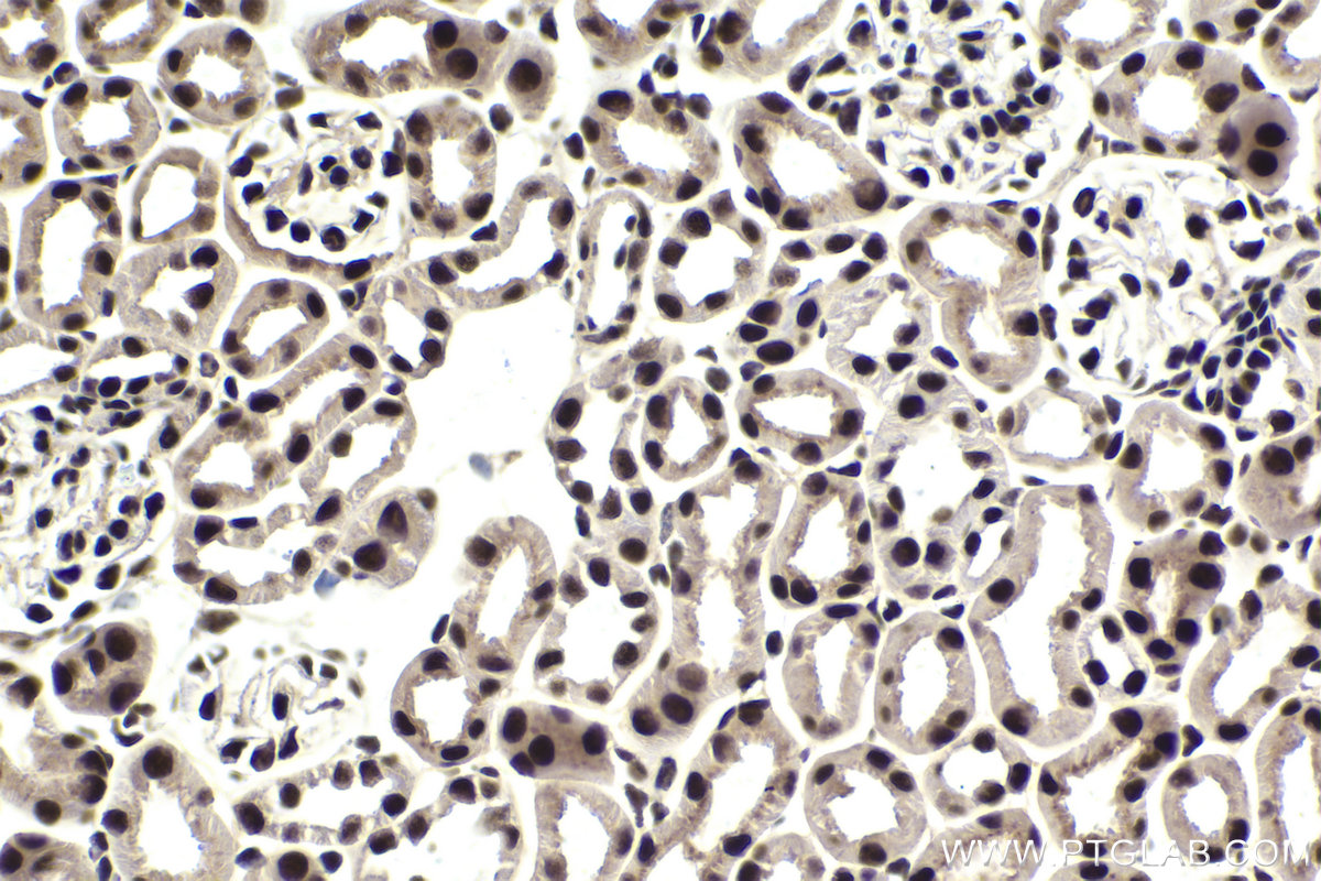 Immunohistochemical analysis of paraffin-embedded mouse kidney tissue slide using KHC1814 (CDC73 IHC Kit).
