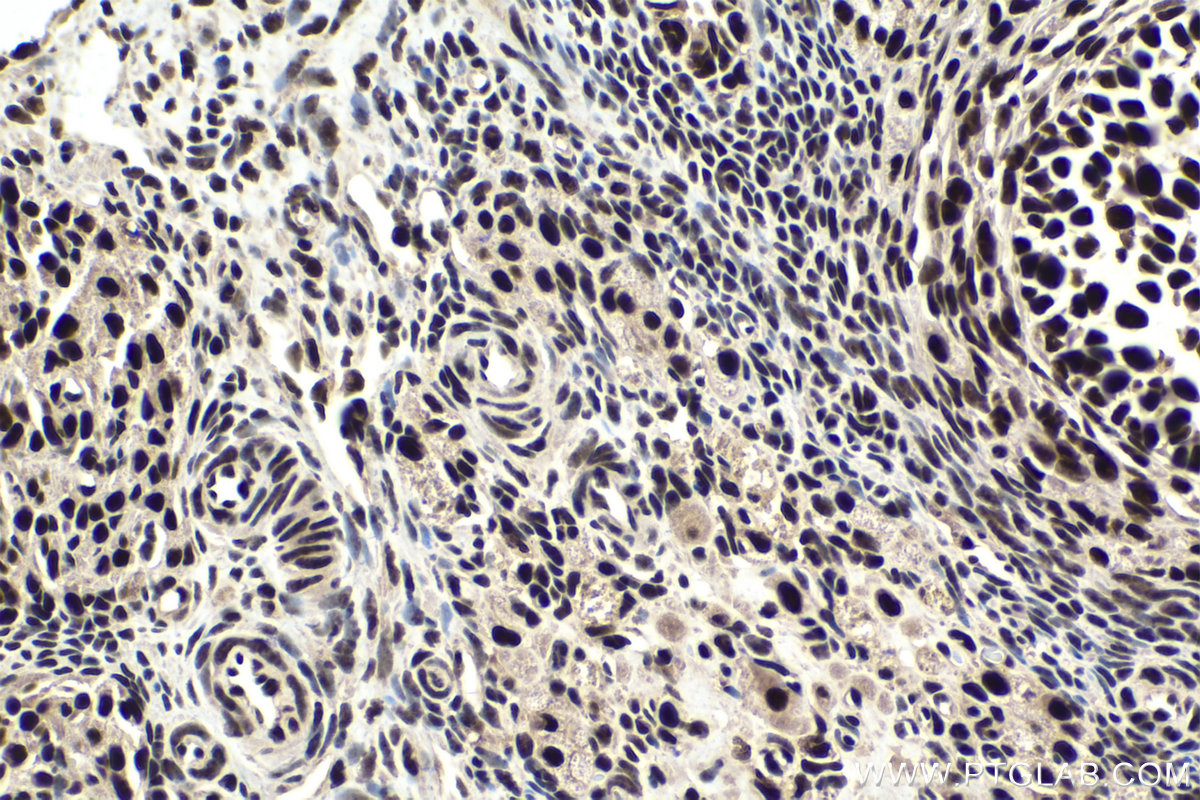Immunohistochemical analysis of paraffin-embedded rat ovary tissue slide using KHC1814 (CDC73 IHC Kit).