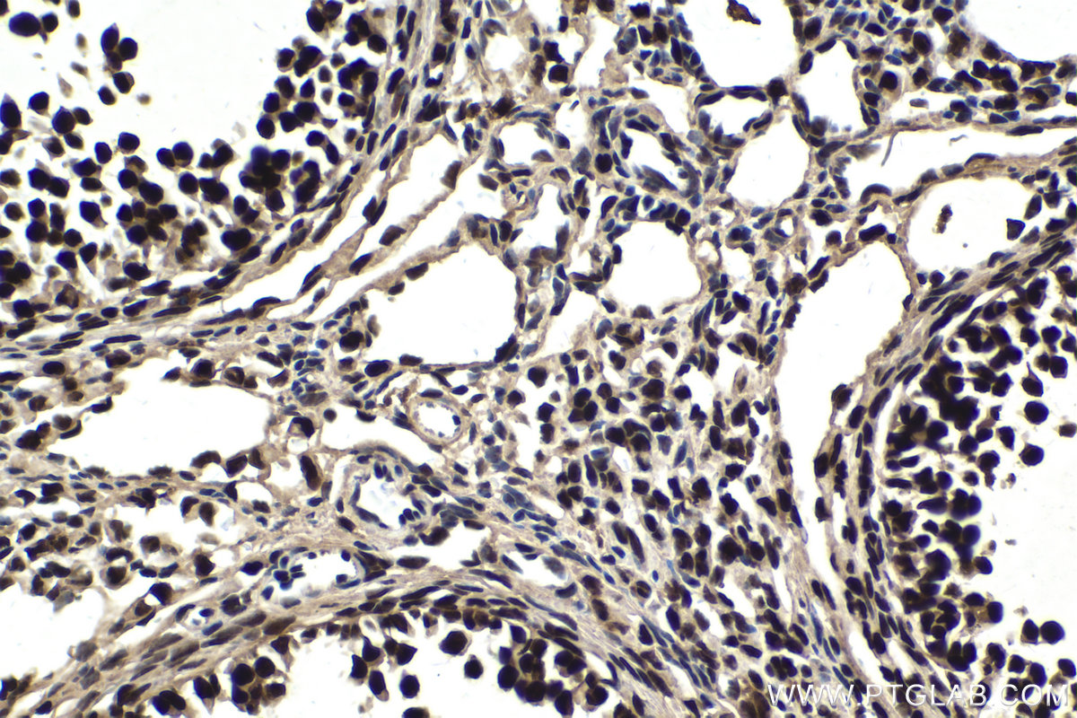 Immunohistochemical analysis of paraffin-embedded mouse ovary tissue slide using KHC1814 (CDC73 IHC Kit).