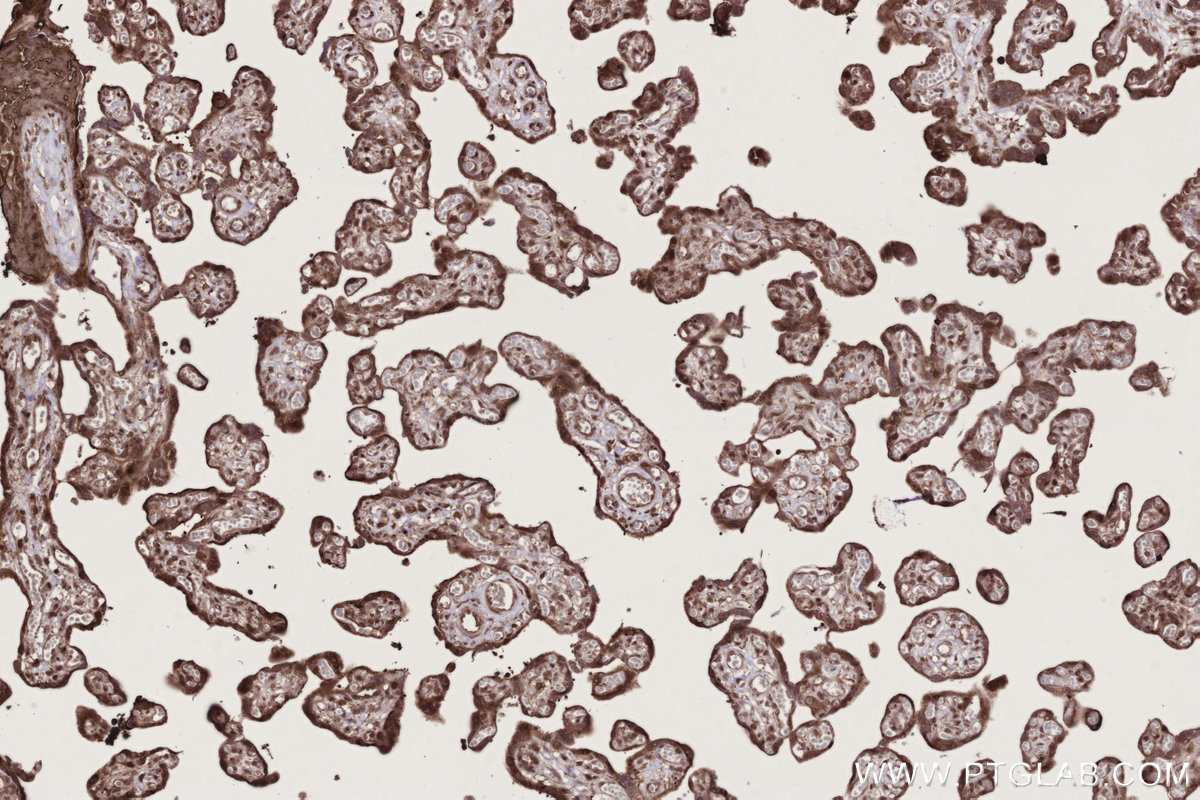 Immunohistochemical analysis of paraffin-embedded human placenta tissue slide using KHC2795 (CDCA7L IHC Kit).