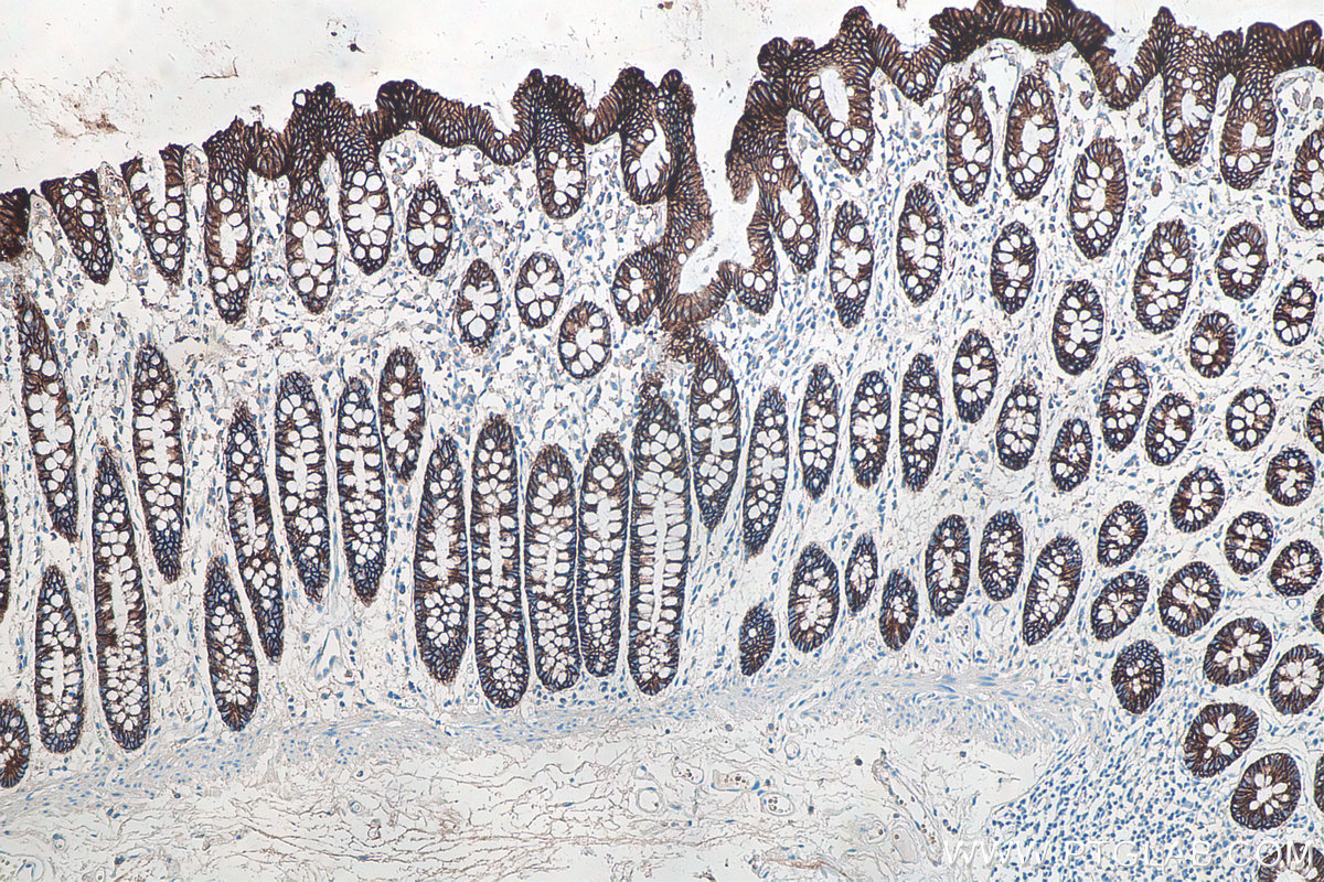 Immunohistochemical analysis of paraffin-embedded human colon tissue slide using KHC0255 (CDH17 IHC Kit).