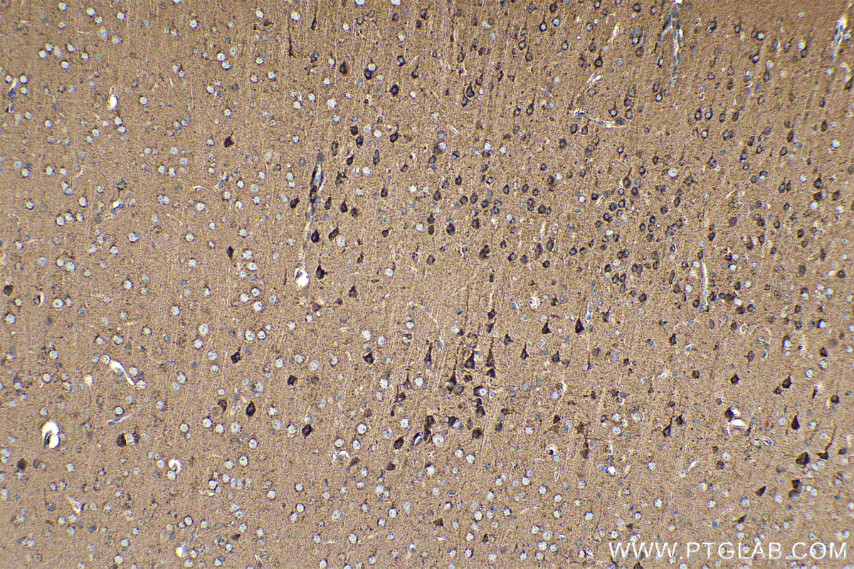 Immunohistochemical analysis of paraffin-embedded mouse brain tissue slide using KHC0254 (CDH7 IHC Kit).