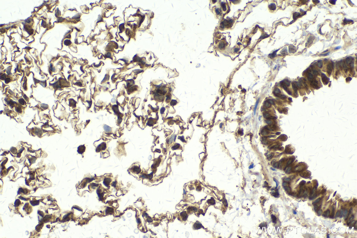 Immunohistochemical analysis of paraffin-embedded rat lung tissue slide using KHC2130 (CDK14/PFTK1 IHC Kit).