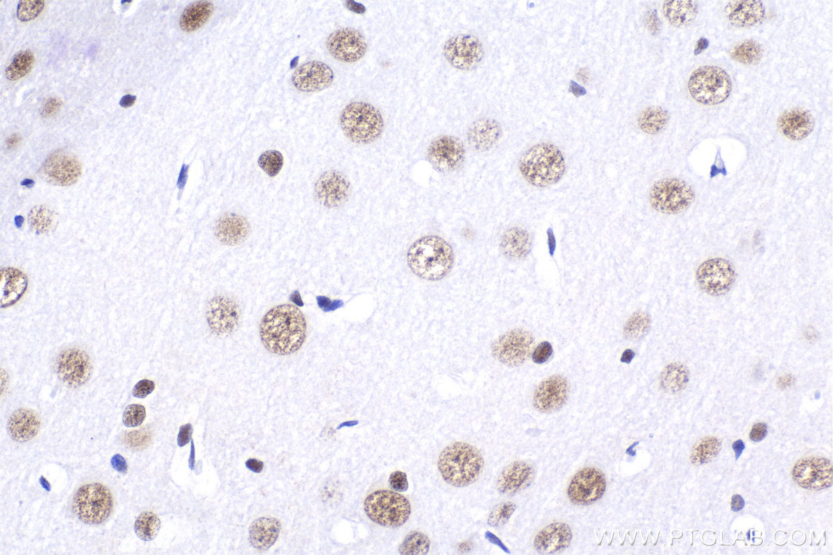 Immunohistochemical analysis of paraffin-embedded rat brain tissue slide using KHC2053 (CDK2AP1 IHC Kit).