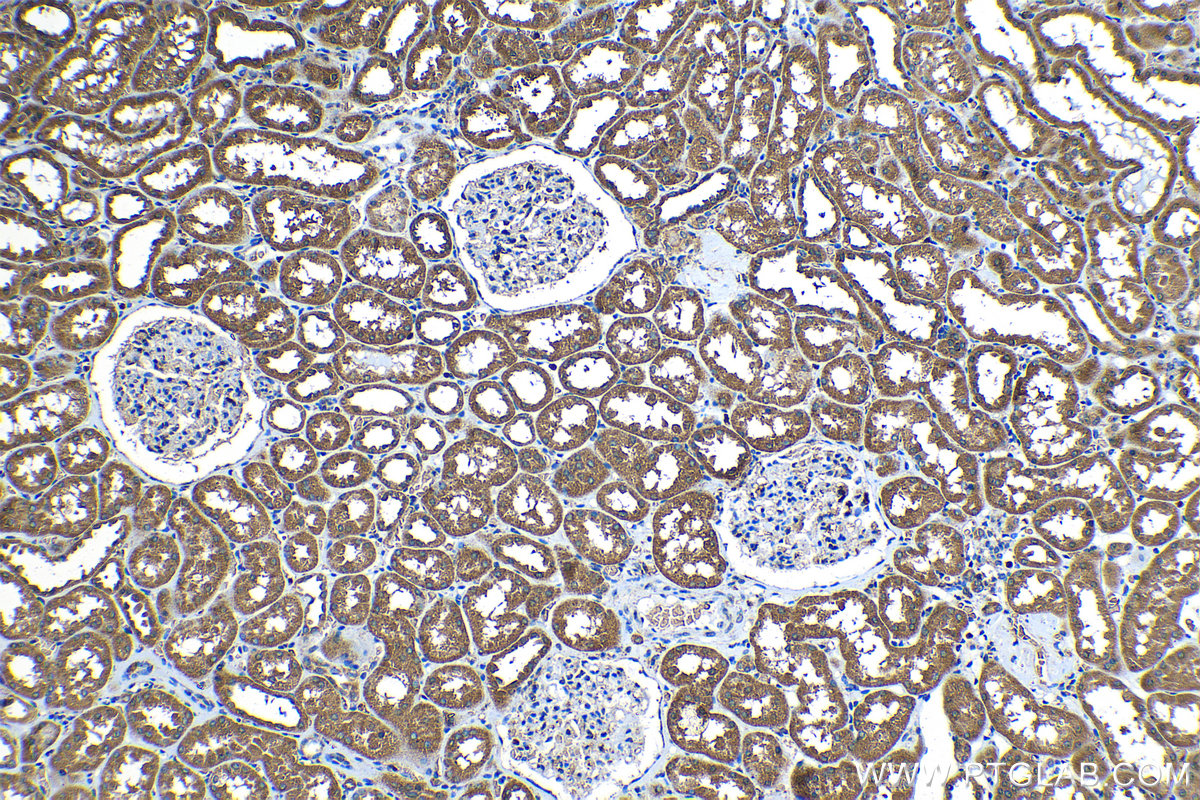 Immunohistochemical analysis of paraffin-embedded human kidney tissue slide using KHC1187 (CDK3 IHC Kit).