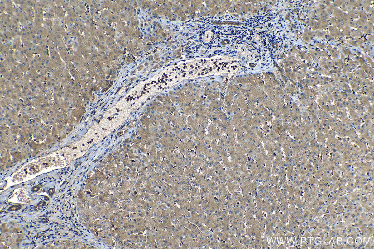 Immunohistochemical analysis of paraffin-embedded human liver tissue slide using KHC1187 (CDK3 IHC Kit).