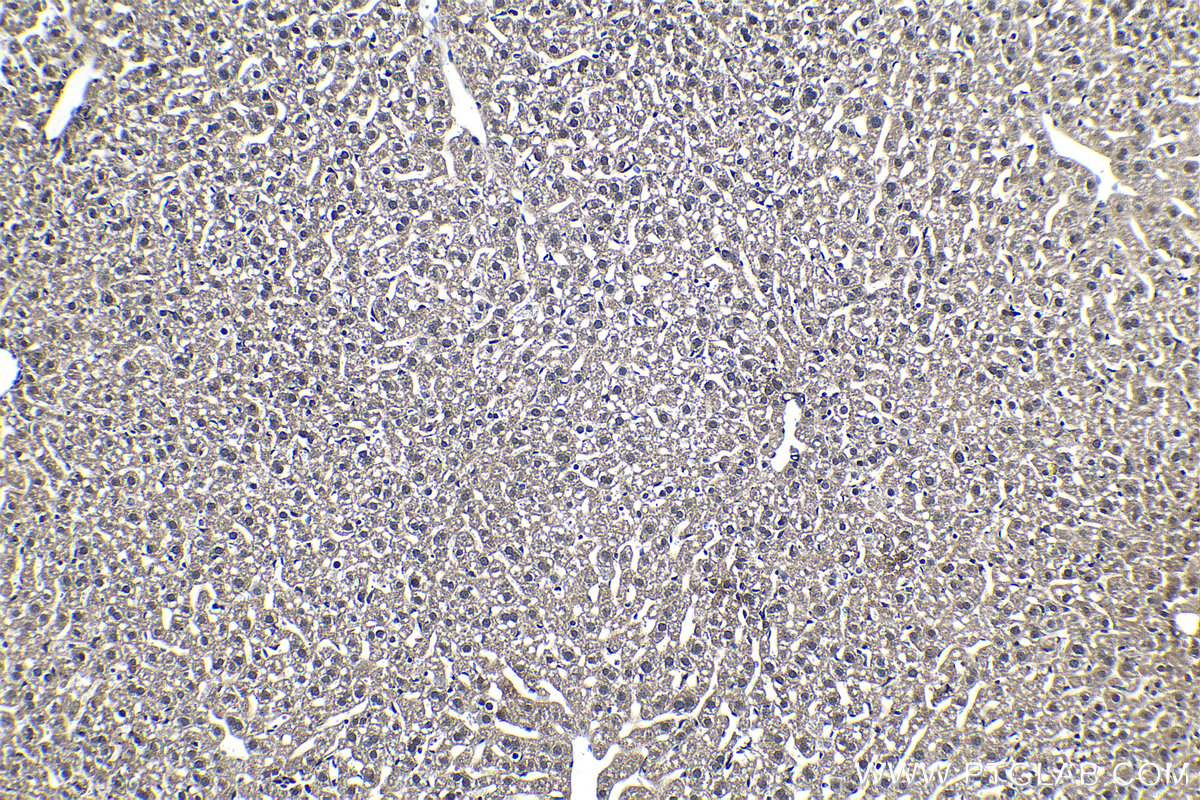 Immunohistochemical analysis of paraffin-embedded mouse liver tissue slide using KHC1187 (CDK3 IHC Kit).