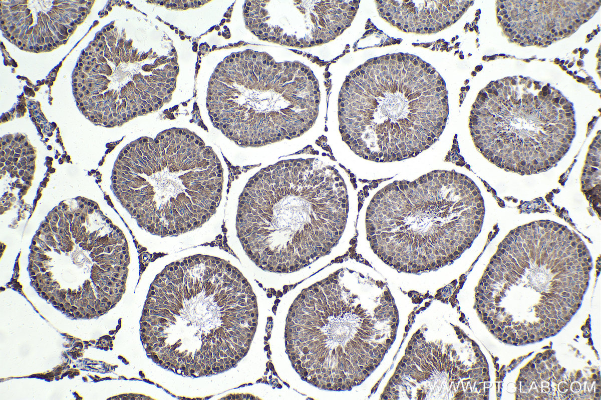 Immunohistochemical analysis of paraffin-embedded rat testis tissue slide using KHC1657 (CDK5 IHC Kit).