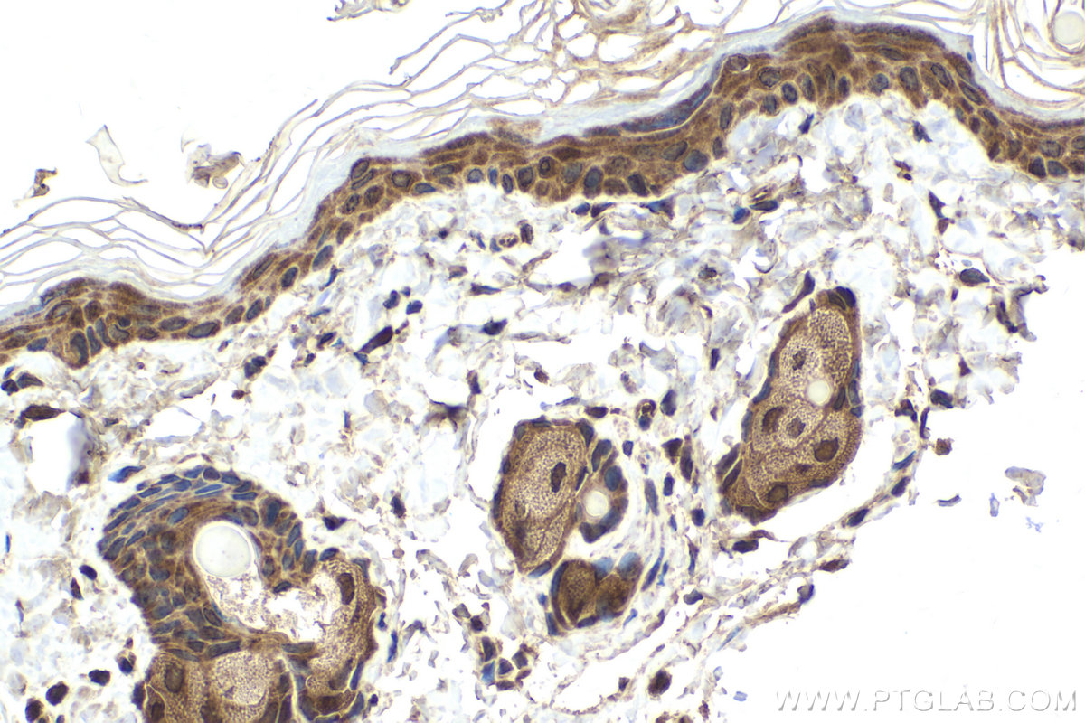 Immunohistochemical analysis of paraffin-embedded rat skin tissue slide using KHC1657 (CDK5 IHC Kit).