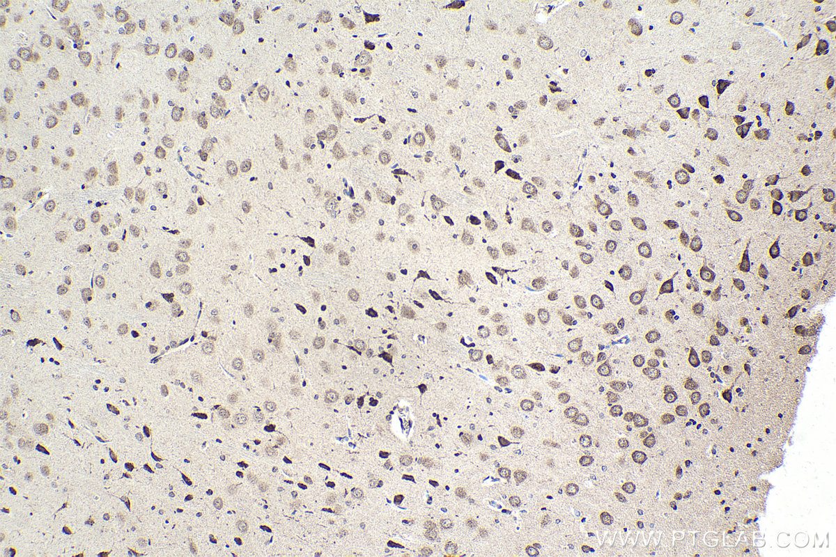Immunohistochemical analysis of paraffin-embedded rat brain tissue slide using KHC1657 (CDK5 IHC Kit).