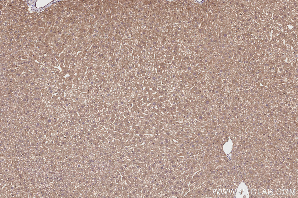 Immunohistochemical analysis of paraffin-embedded mouse liver tissue slide using KHC2834 (CDK5RAP2 IHC Kit).