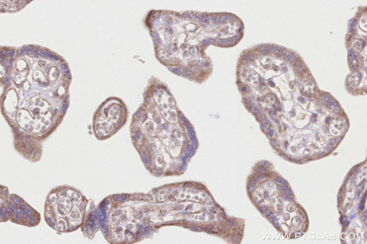 Immunohistochemical analysis of paraffin-embedded human placenta tissue slide using KHC2834 (CDK5RAP2 IHC Kit).