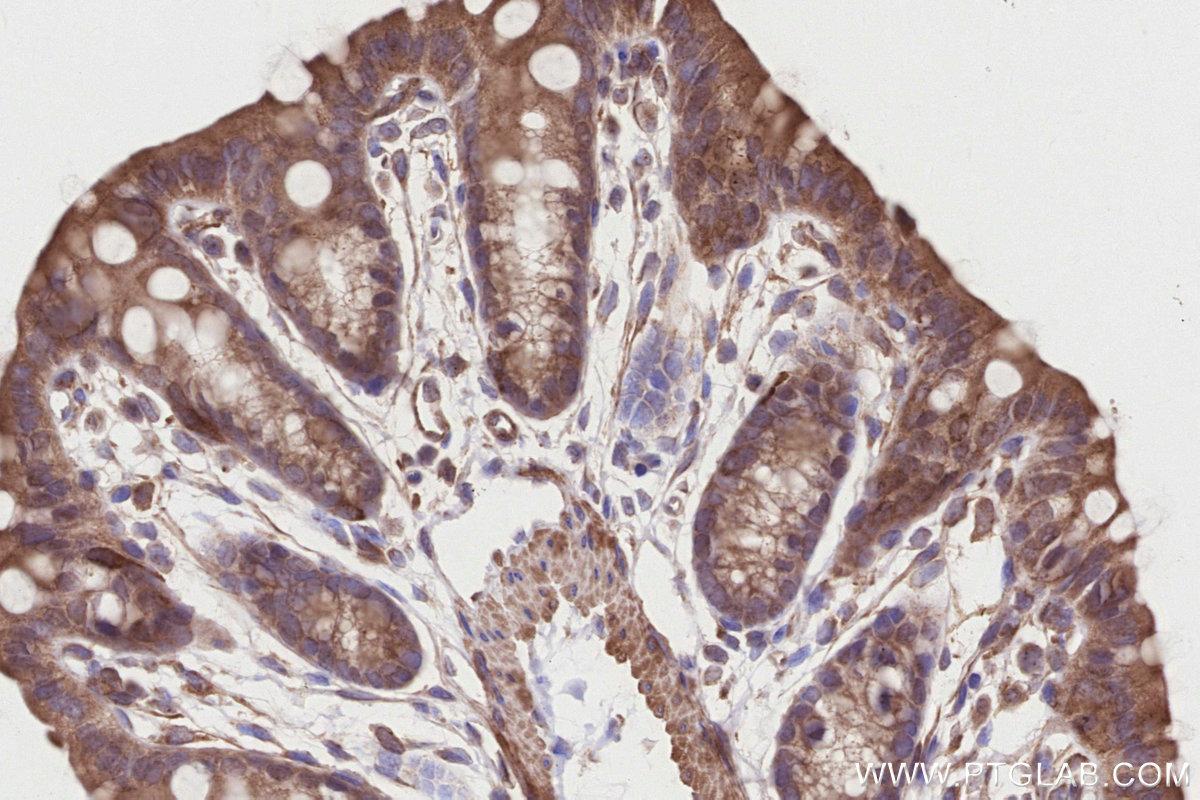 Immunohistochemical analysis of paraffin-embedded mouse colon tissue slide using KHC2834 (CDK5RAP2 IHC Kit).