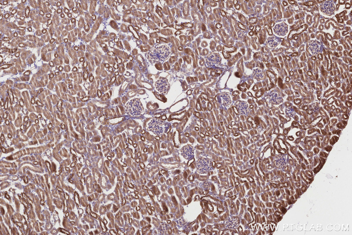 Immunohistochemical analysis of paraffin-embedded mouse kidney tissue slide using KHC2834 (CDK5RAP2 IHC Kit).