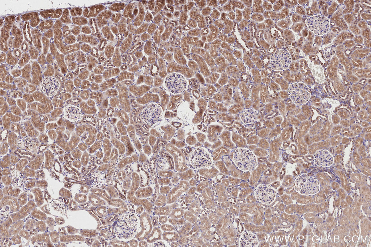 Immunohistochemical analysis of paraffin-embedded rat kidney tissue slide using KHC2834 (CDK5RAP2 IHC Kit).