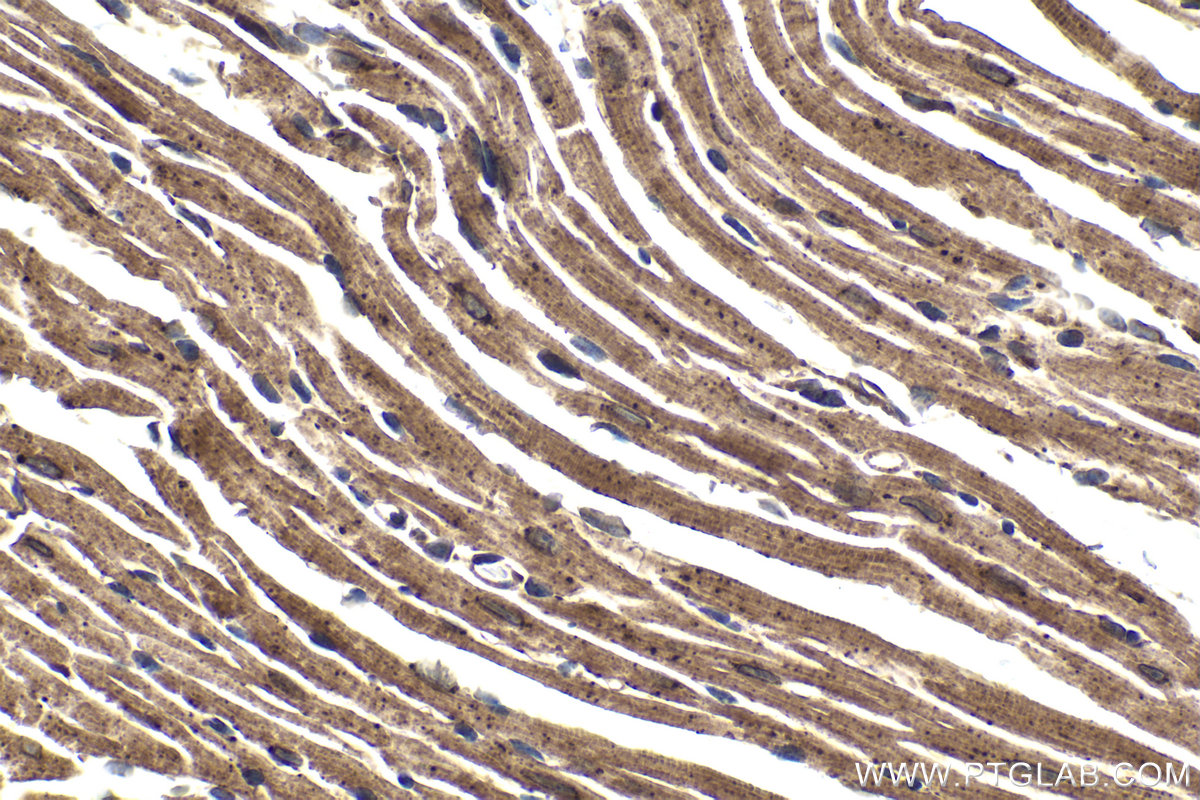 Immunohistochemical analysis of paraffin-embedded mouse heart tissue slide using KHC1876 (CDK5RAP3 IHC Kit).