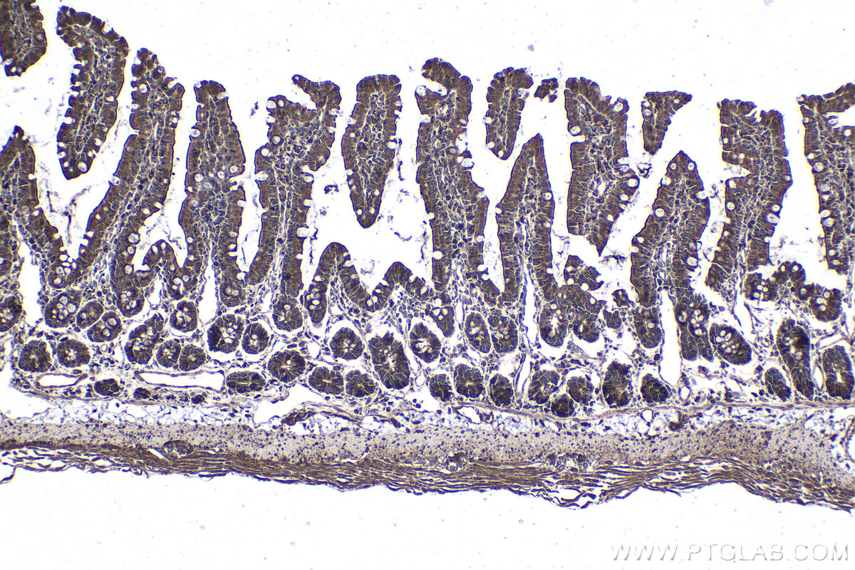 Immunohistochemical analysis of paraffin-embedded rat small intestine tissue slide using KHC1876 (CDK5RAP3 IHC Kit).