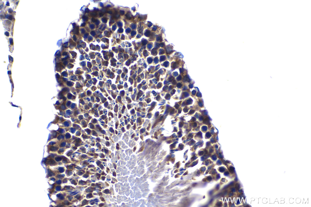 Immunohistochemical analysis of paraffin-embedded rat testis tissue slide using KHC1068 (CDK6 IHC Kit).