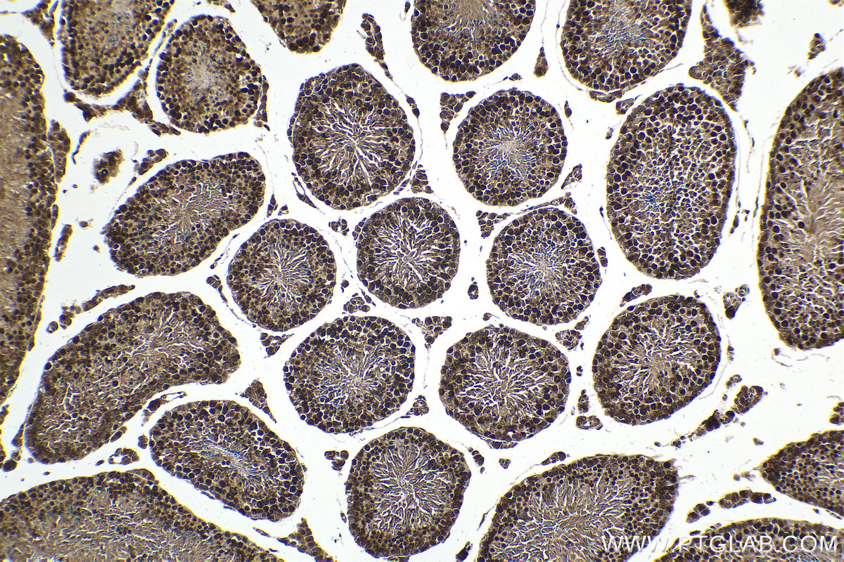 Immunohistochemical analysis of paraffin-embedded mouse testis tissue slide using KHC1616 (CDK7 IHC Kit).